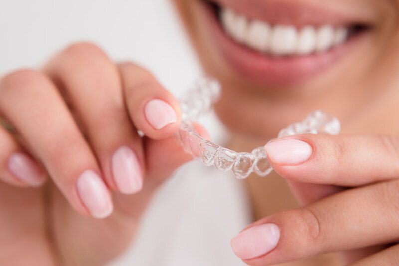 Clear Aligners, Invisible Braces - San Jose Dental Services